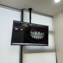 화목치과의원 | 미백치과 : 치아미백 원데이 받고 온 후기 (통증,전후사진)