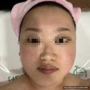 대승정보시스템 | 강남역피부관리 에스테틱공간 2호점 F.M (Face Massage) + 매직리프팅 솔직후기