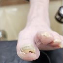 네일크루 이미지