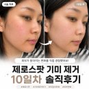 제로 | [수원] 미작뷰티 제로스팟 리얼후기