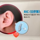 스마일보청기 이미지