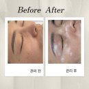 밝음메디 | 김해 율하 피부관리 추천- 더밝음 메디 에스테틱 맞춤 피부관리