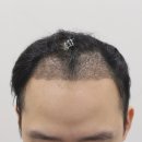 압구정맘모스헤어라인의원 이미지