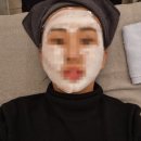 [올리디아볼륨 스킨부스터] 통증 멍 붓기 효과! 천호 피부과 일주일 솔직후기