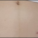 스킨새로이 이미지