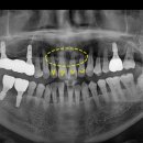 이승훈치과의원 이미지