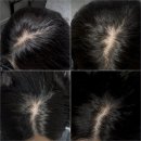 트인자리애 3차 | 청주 SMP STUDIO 후기｜정수리·가르마 밀도 보강 직접 받아본 솔직 기록