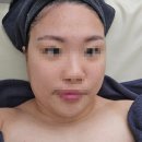 이프네 스킨앤바디 | [화성] 향남 피부관리 추천! 민감피부 살리는 &#34;하담스킨앤바디&#34; 안온관리 후기