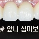 샤인 치과기공소 이미지