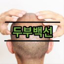두부 백선
