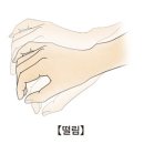 진전(tremor)[Tremor] 이미지