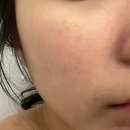 마곡 피부관리 리즈베리뷰티 후기