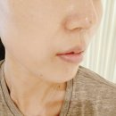 리지에스테틱 | 대구신부관리 대봉동피부관리 노멀리즈에스테틱 대구본점 [물광 퍼밍 + 데콜테 마사지까지 완벽]