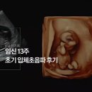 나비산부인과의원 | 미래아이산부인과|초기 입체초음파하는 이유, 후기