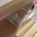 23년 4월 _ 담낭 제거 수술 (인생 첫 수술!)