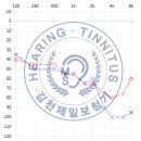 메디컬 보청기 이미지