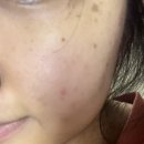 (주)이지함화장품 | 닥터슈라클 5알파 컨트롤 클리어링 크림 후기