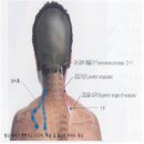 Re:흉쇄유돌근 통증 문의합니다. 이미지