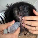 피알샵 | [2주 리얼후기] 두피 자생앰플, 리필드 엑소좀 앰플로 관리하는 상쾌한 일상