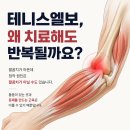 테니스엘보가 반복된다면? 팔꿈치가 아닌 어깨 근육을 확인해 보세요. 이미지