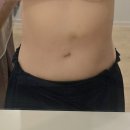 리즈커머스 | " 복부 리즈실 실리프팅 후기 " 두 아이 출산 후, 되찾은 자신감✨