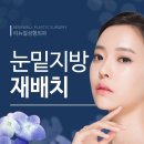 리뉴얼의원