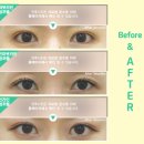 미호성형외과의원 이미지