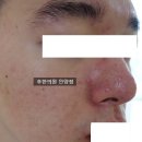 후한의원 네이버블로그