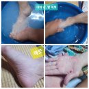 척척의료기 | 할머니 간병 44일차 후기