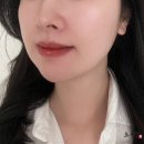 장안로52번길 | 분당 피부관리 모공관리 고원장의모공세척테라피 분당점 후기