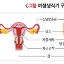 경부길이, 질길이, 자궁크기, 자궁벽 두께 (임신, 자궁경부무력증, 조산 위험) 이미지