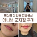 에니 | 왕십리 장안동 입술문신 자연스러운 입술톤 찾는다면 에니브 군자점 후기