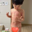 원흥아이제일병원 네이버블로그