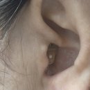 (주)독일스타보청기 | 서면보청기제작 할머니께 맞는 제품 알아보고 상담받은 독일스타보청기