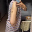 수지로296번길 | 수지 다이어트 웨딩관리 팔뚝 부유방 제로팻 주사 5회차 마지막 후기