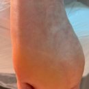 레푸스 화정점 이미지