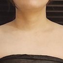 아나덴 슈가링왁싱 용인동백역점 네이버블로그