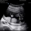 서울미즈여성의원 이미지