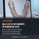 미소를심는서울치과의원 | 이수역치과 | 앞니 임플란트 후기 검색하기 전 꼭 알아야 할 3가지