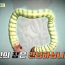 닥터의 경고, 대장질환 이미지