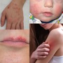 달천한의원 | [울산 자운고 한의원] 한방피부연고 자운고를 직접 만듭니다. 자운고 효능. 피부건조, 피부상처회복...