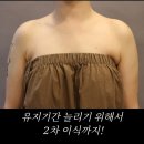 연세의원 | 일자어깨 제니어깨 지방이식 연세루다의원 내돈내산후기