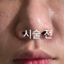 청담피부