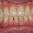 모양치과기공소 이미지