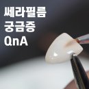 QNA치과 네이버블로그