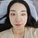 비니래쉬앤뷰티 이미지