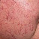 미클린의원 이미지