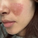 부산 플라즈마 전포 에스테틱 메이니뷰티 생생 후기