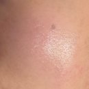 솔케어 | 대봉동에스테틱 솔에스테틱 물광집중케어 후기