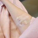 대장내시경 용종 제거 조직검사 비용 실비 후기